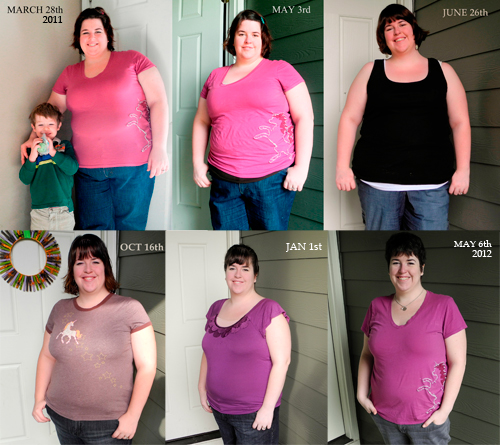 Lap Band Weight Loss Journey Stories